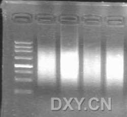PCR条带弥散的问题 [转自 丁香园轮论坛] - 经验