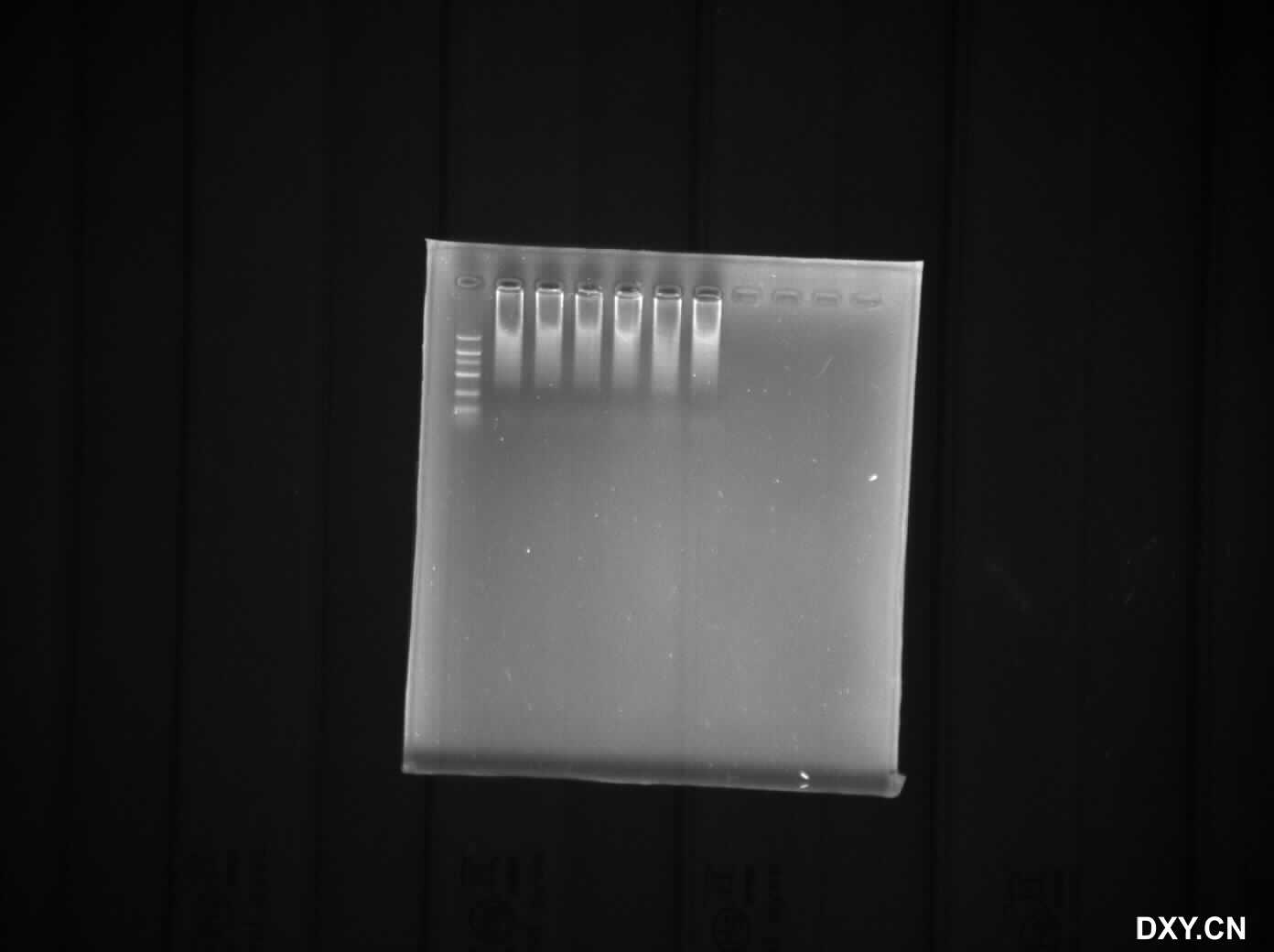 求助:PCR电泳结果包括阴性对照都拖带 - 经验