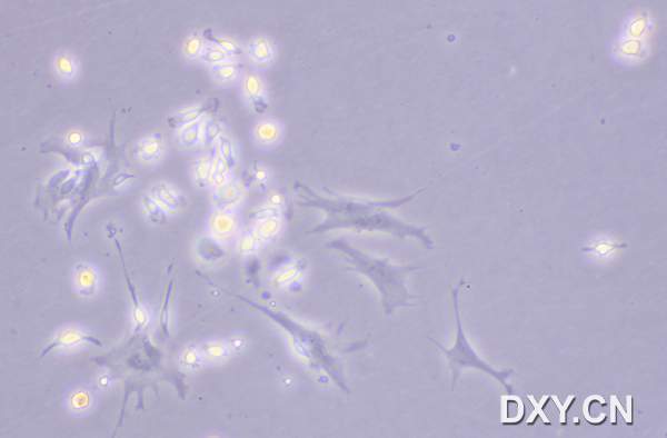 [求助]裸鼠DC树突状细胞培养求鉴定 - 经验共享