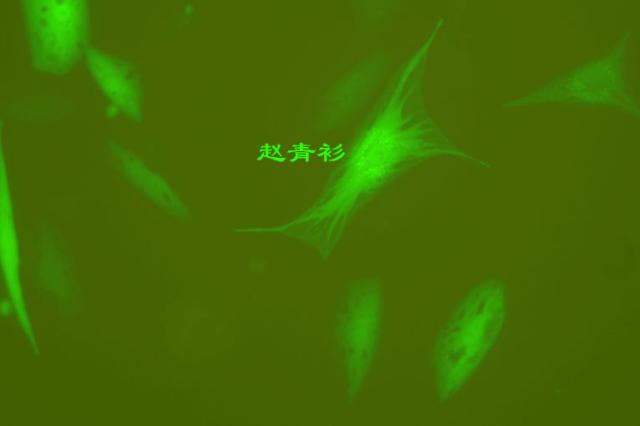 用GFP转染的兔原代培养膀胱上皮细胞照片 - 经